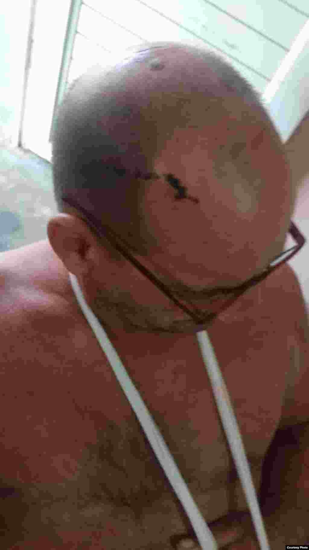 Leonel Murgado resultó herido al tratar de salvar a su sobrino, que falleció por apuñalamiento en el hecho violento ocurrido el 22 de agosto de 2024 en Bauta, provincia Artemisa.