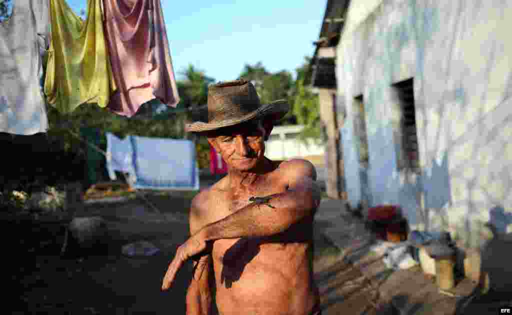 Su secreto consiste en dejarse picar de vez en cuando por un alacrán cuyo veneno, además de ser inocuo, contiene propiedades analgésicas y antiinflamatorias.