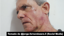 "Un joven teniente coronel de la Seguridad del Estado, supuestamente nombrado Yoán, por decirle cínico y fascista, me dio con todo y lo demostró con creces", denunció Jorge Fernández Era.