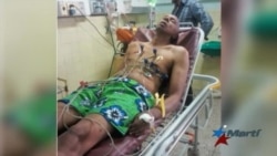 Unión Europea manifiesta preocupación por el estado de Guillermo Fariñas Unión Europea manifiesta preocupación por el estado de Guillermo Fariñas